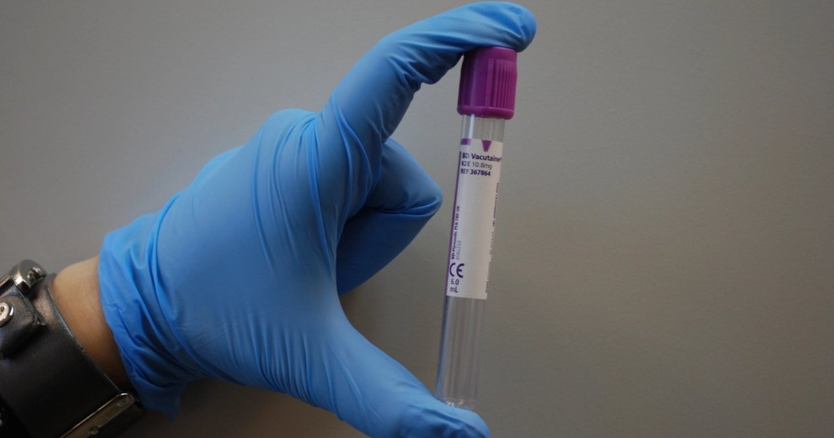 A gloved hand holding a blood sample test tube